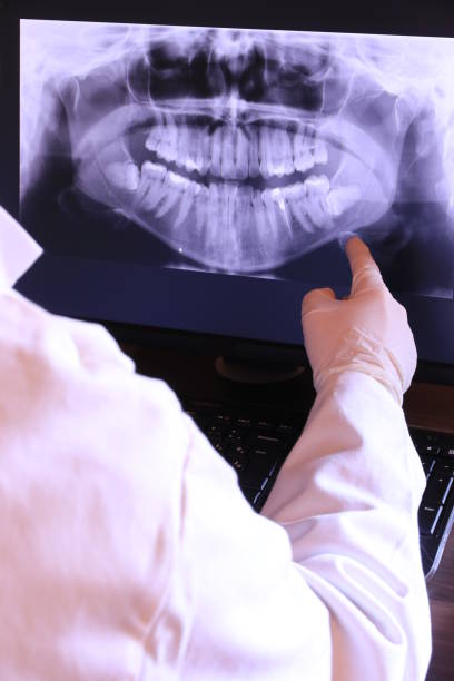 Best Mobile Emergency Dentist in Harveys Lake, PA